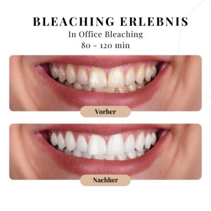 bleaching erlebnis verschenken